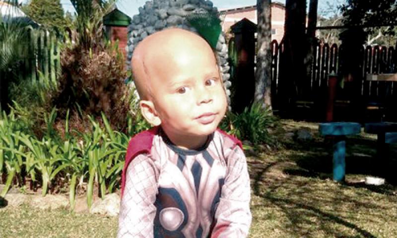 Criança de dois anos enfrenta câncer raro na cabeça
