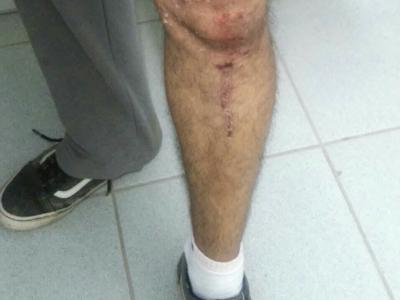 Senhor é agredido por negar carona a menores