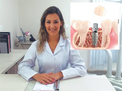 Implante dentário