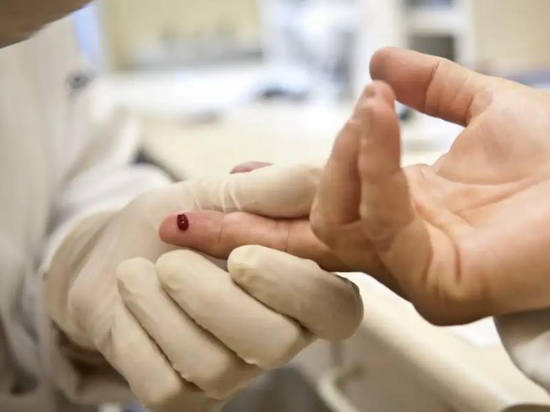 Casos de sífilis e de HIV/aids aumentam entre homens jovens