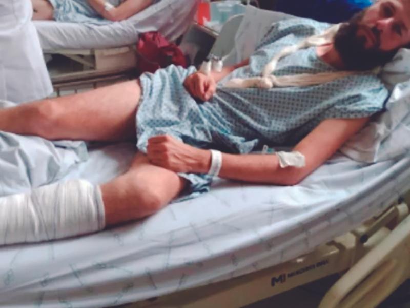 Motociclista sofre dois acidentes graves em menos de dois anos e pede ajuda