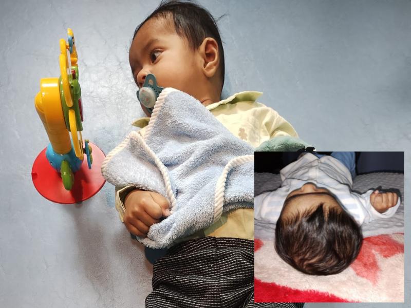 Bebê precisa de capacete ortopédico para tratar deformidade craniana e família faz campanha solidária