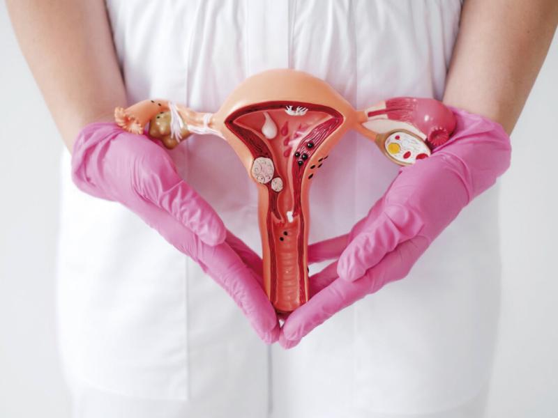 Dor menstrual intensa pode esconder endometriose e diagnóstico pode demorar até 10 anos